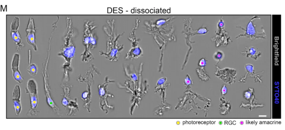 Micrograph gallery of DES-dissociated retinal cells labeled by type (photoreceptor, RGC, likely amacrine) shown in brightfield and SYTO40 stain